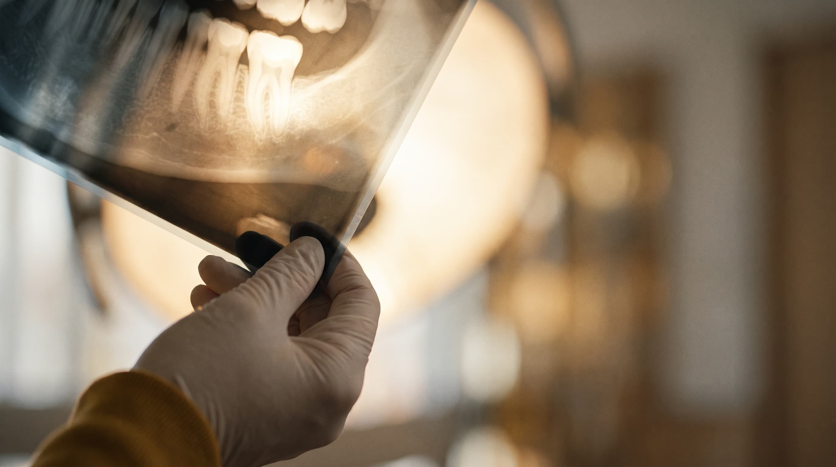 Kostenberatung zur Weisheitszahn-OP bei dentalReinisch
